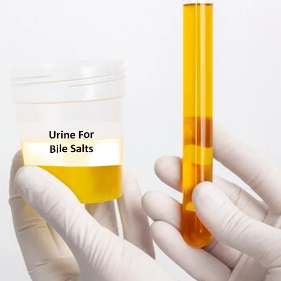 BS (Bile Salts), Urine